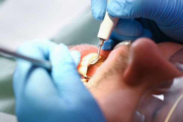 Best Tooth Infection Emergency Dentist  in Canton, SD