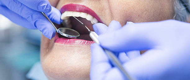 Best Chipped Tooth Repair Near Me  in Canton, SD